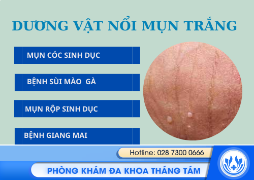 duong vat len mun trang