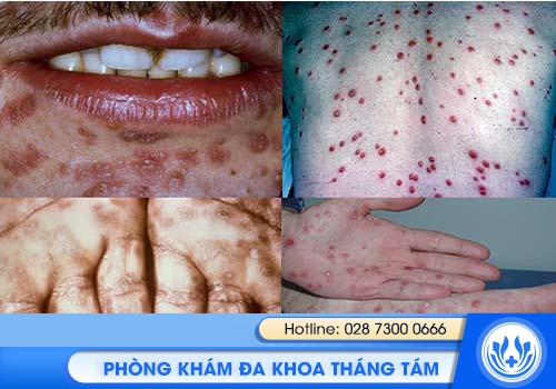 tổng quan bệnh xã hội