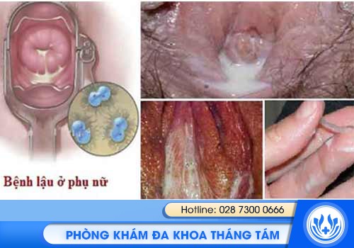 tổng quan bệnh xã hội