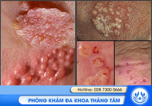 bệnh viện da liễu chuyên khám bệnh xã hội