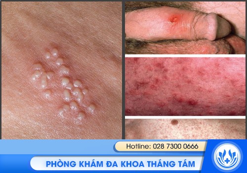 bệnh viện da liễu chuyên khám bệnh xã hội