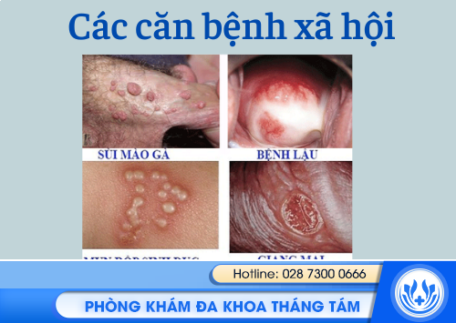 các bệnh liện quan đến tình dục