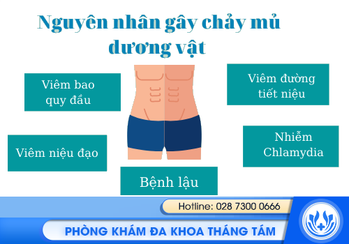 chảy mủ vùng kín