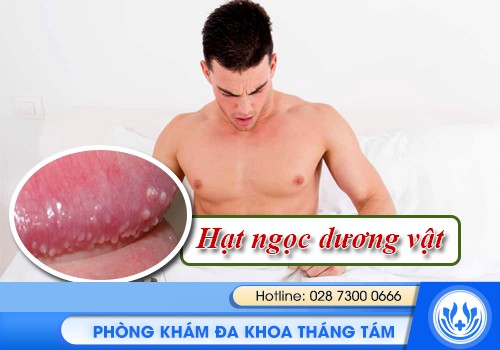 hạt ngọc dương vật