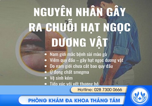 hạt ngọc dương vật