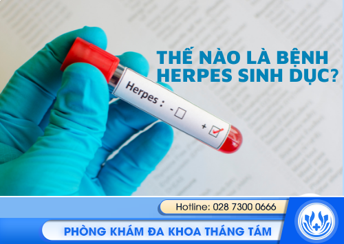 herpes sinh dục