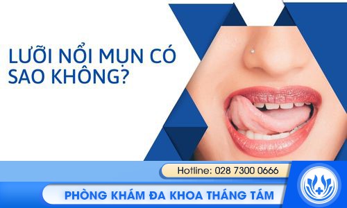 lưỡi nổi mụn có sao không