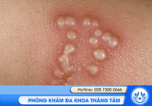 tổng quan bệnh xã hội
