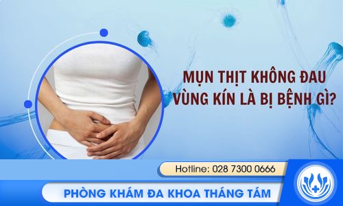 mụn thịt không đau ở vùng kín