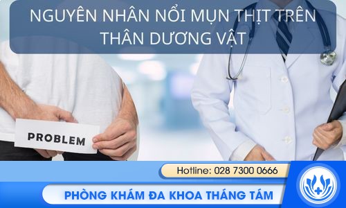 mụn thịt trên thân dương vật