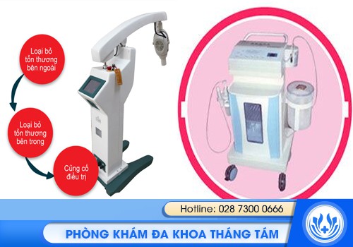 mụn thịt ở âm đạo