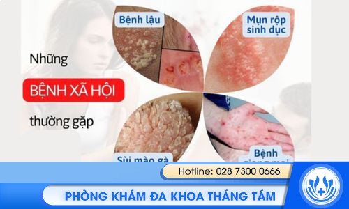Tổng đài tư vấn bệnh xã hội miễn phí
