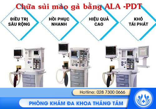 sùi mào gà ở lưỡi