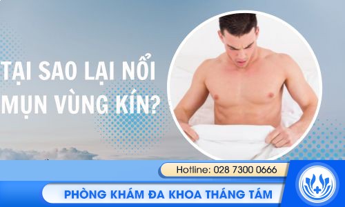 tại sao lại nổi mụn vùng kín