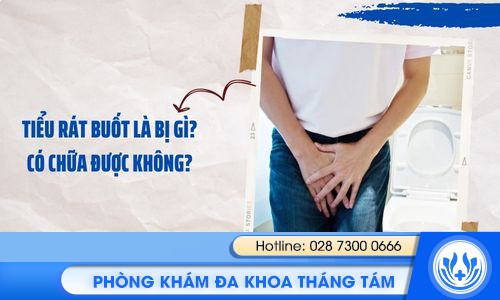 tiểu rát, buốt là bị gì? có chữa được không?