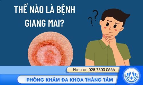 tổng quan về bệnh giang mai