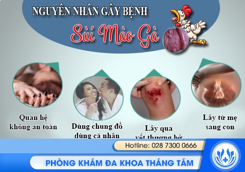 Tổng Quan Về Bệnh Sùi Mào Gà Nguy Hiểm Lây Truyền Qua Đường Tình Dục