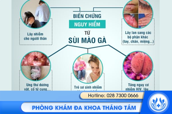 địa chỉ xét nghiệm sùi mào gà uy tín