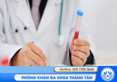 xét nghiệm bệnh lậu