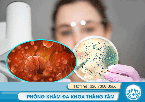 xét nghiệm bệnh lậu